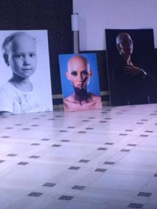 Первая в России фотовыставка людей с алопецией. 9 лет международному клубу лысых